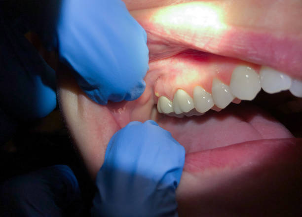 Best Urgent Care for Lost Fillings or Crowns in Courtland, VA